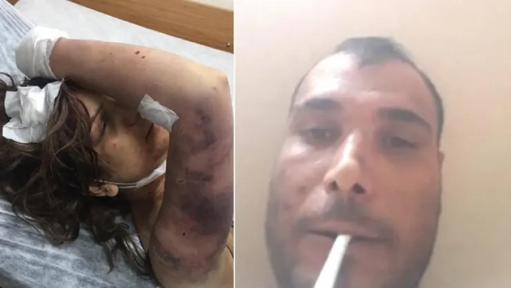 Zincirle bağlayıp, kerpetenle tırnaklarını çekmişti