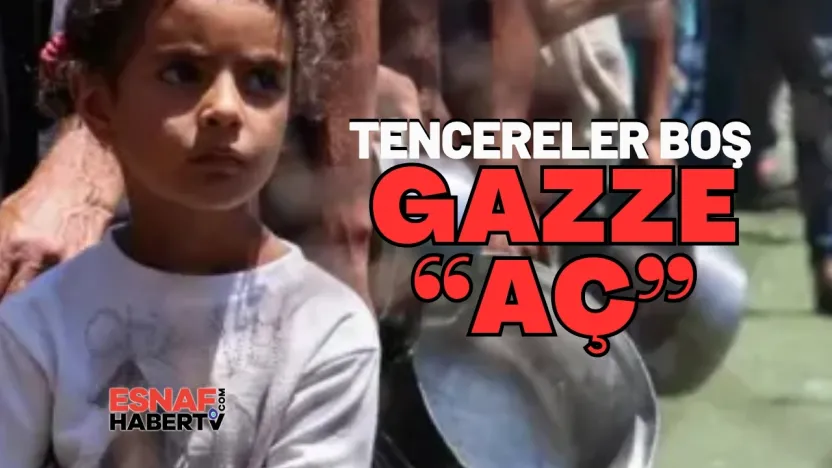 Gazze'nin Çığlığı... Aç Çocuklar Ölüyor, Dünya Sessiz